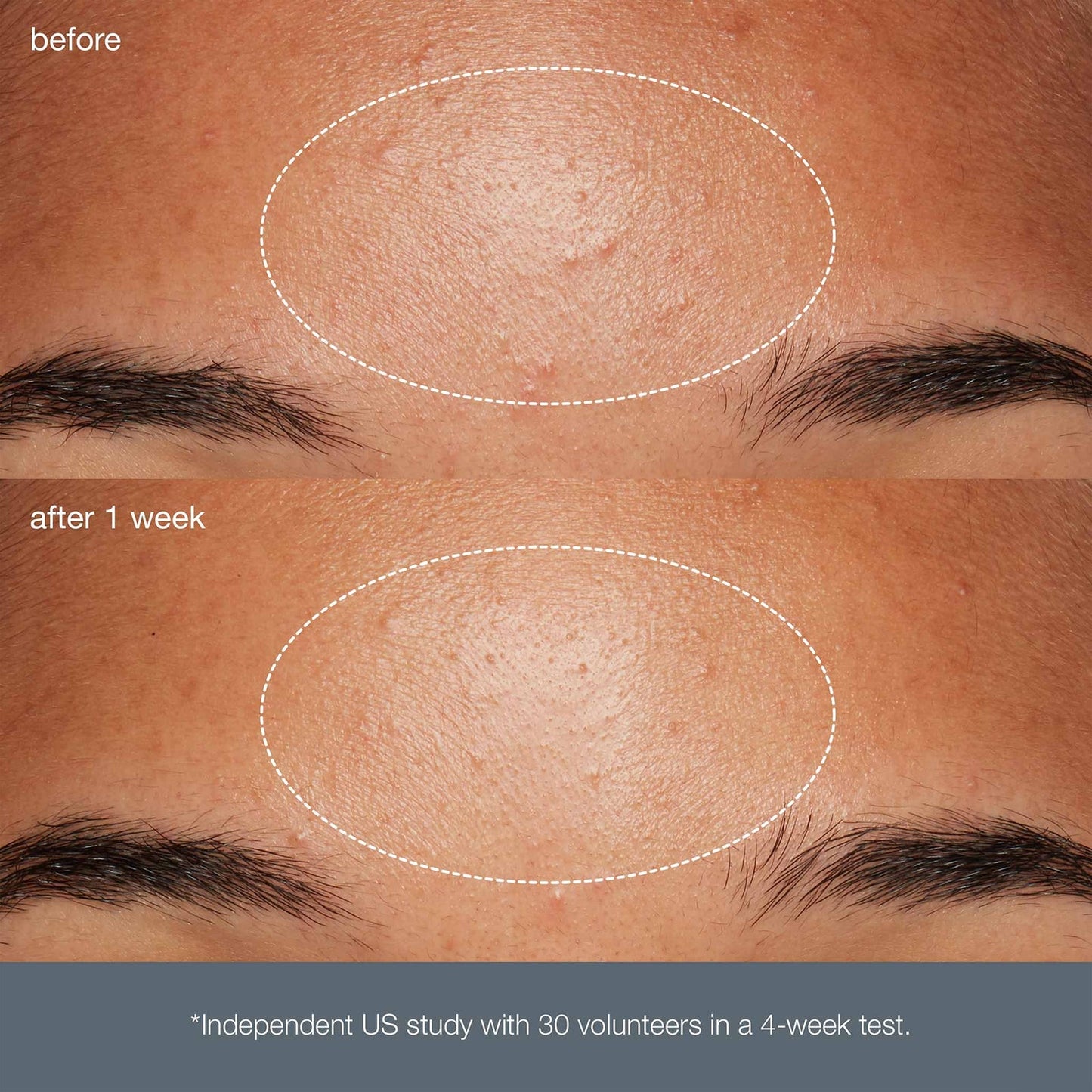 Dermalogica Daily Microfoliant