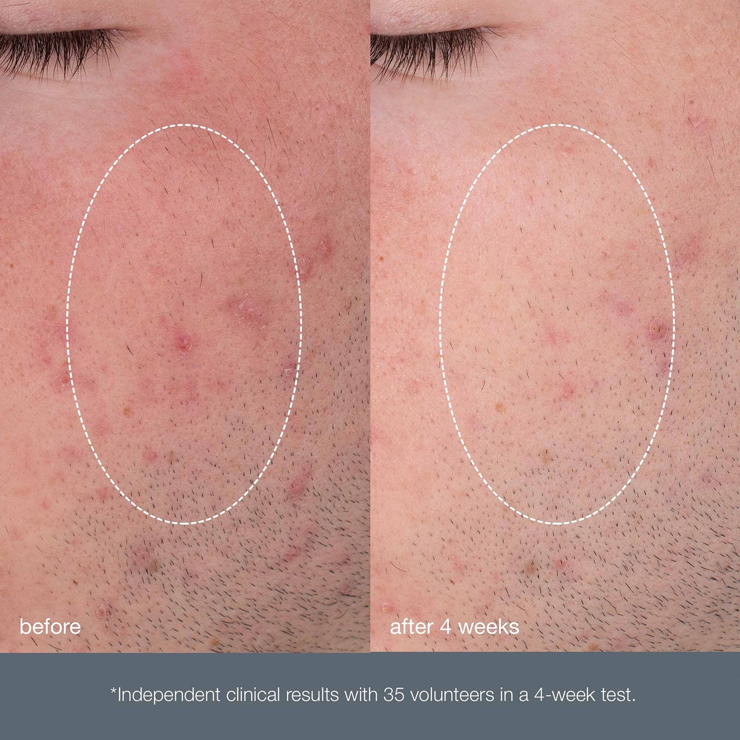 Dermalogica Daily Microfoliant