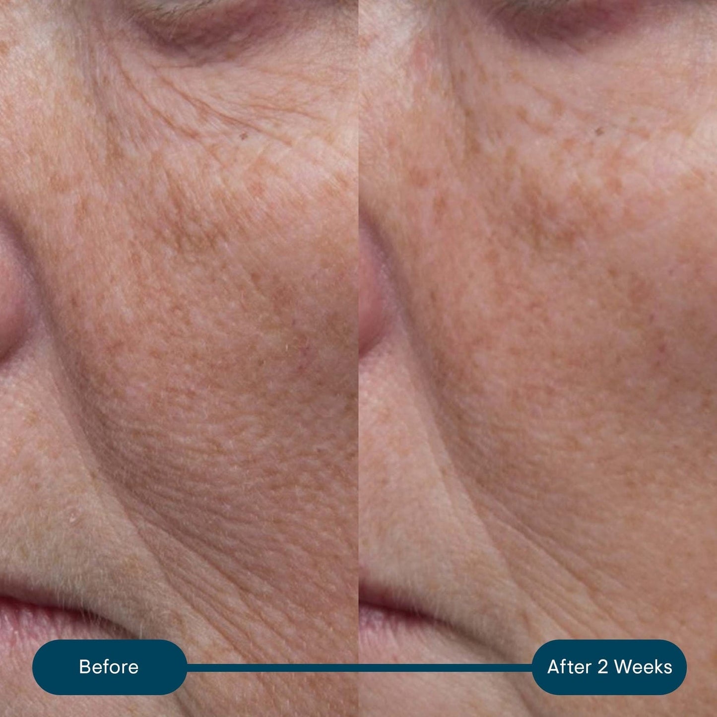 Elemis Pro-Collagen Ultra Rich Marine Cream 50ml