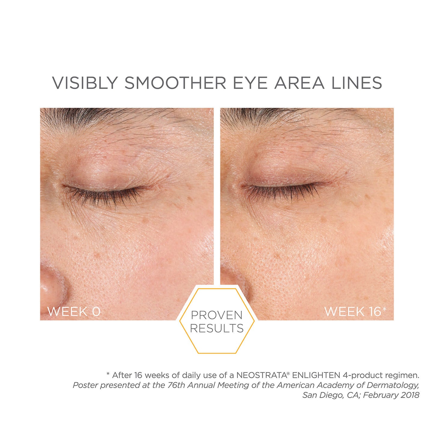 Neostrata Enlighten Pigment Controller Cream with Retinol & Vitamin C 50ml