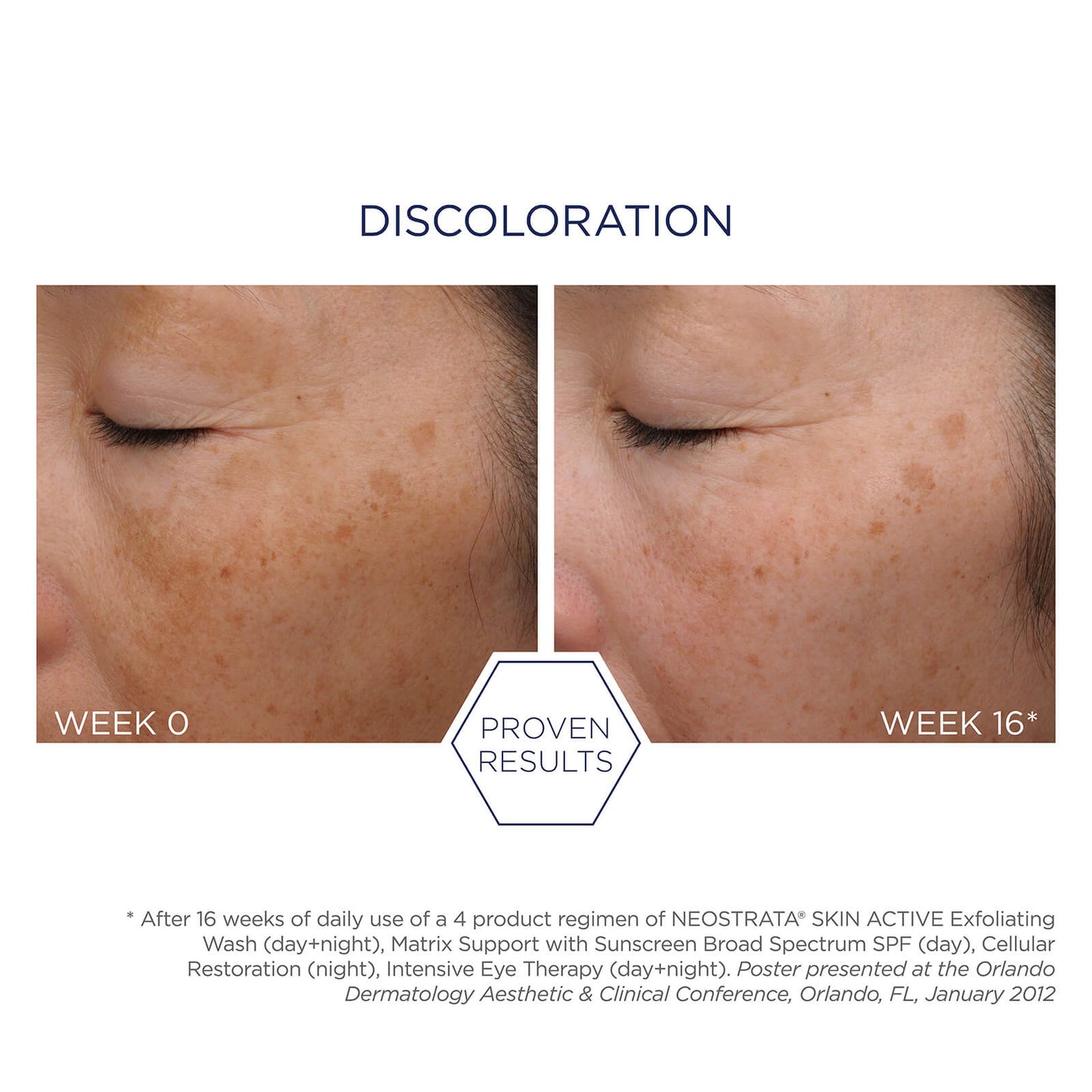 Neostrata Skin Active Cellular Restoration Cream for Mature Skin 50g