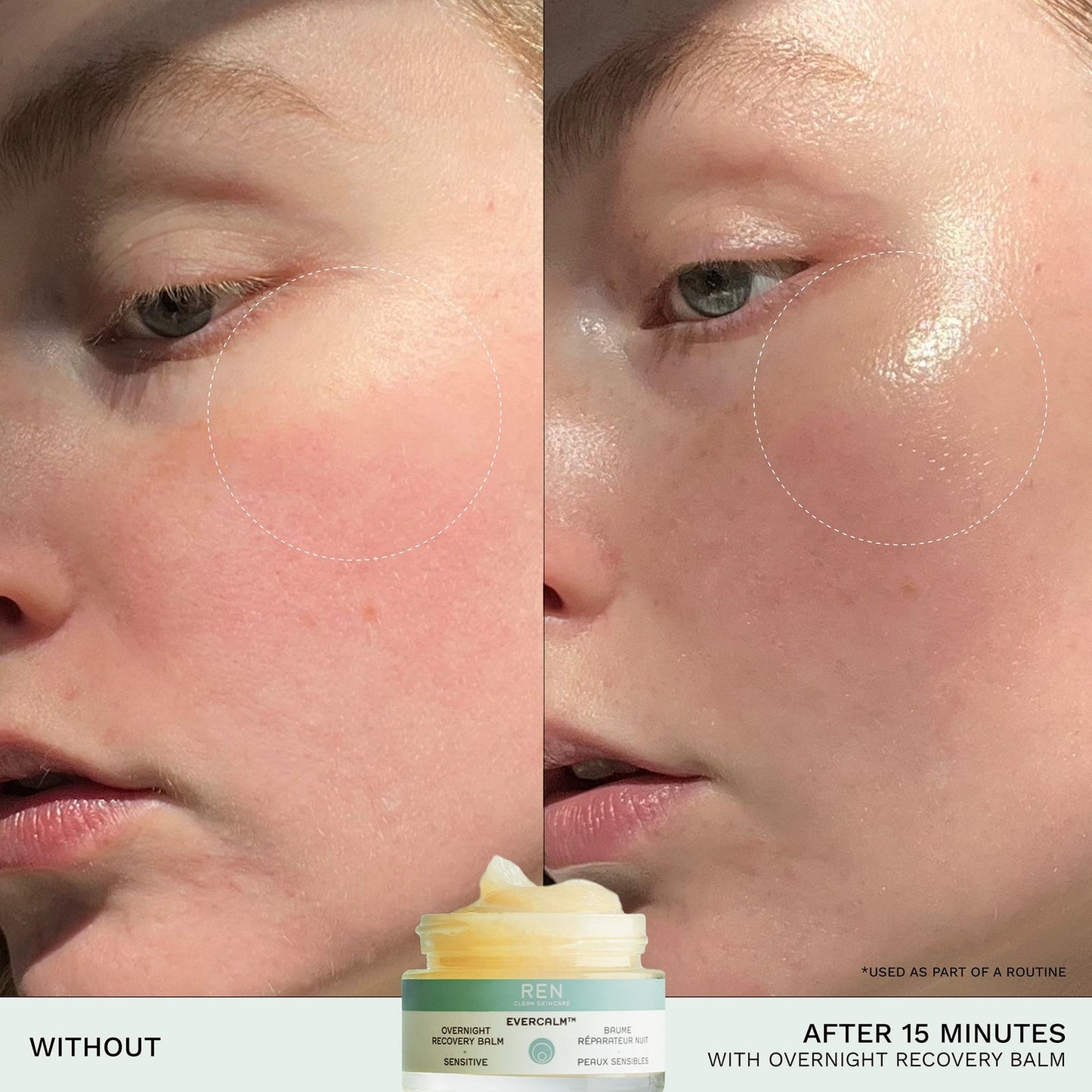 REN Clean Skincare Evercalm™ Overnight Recovery Balm
