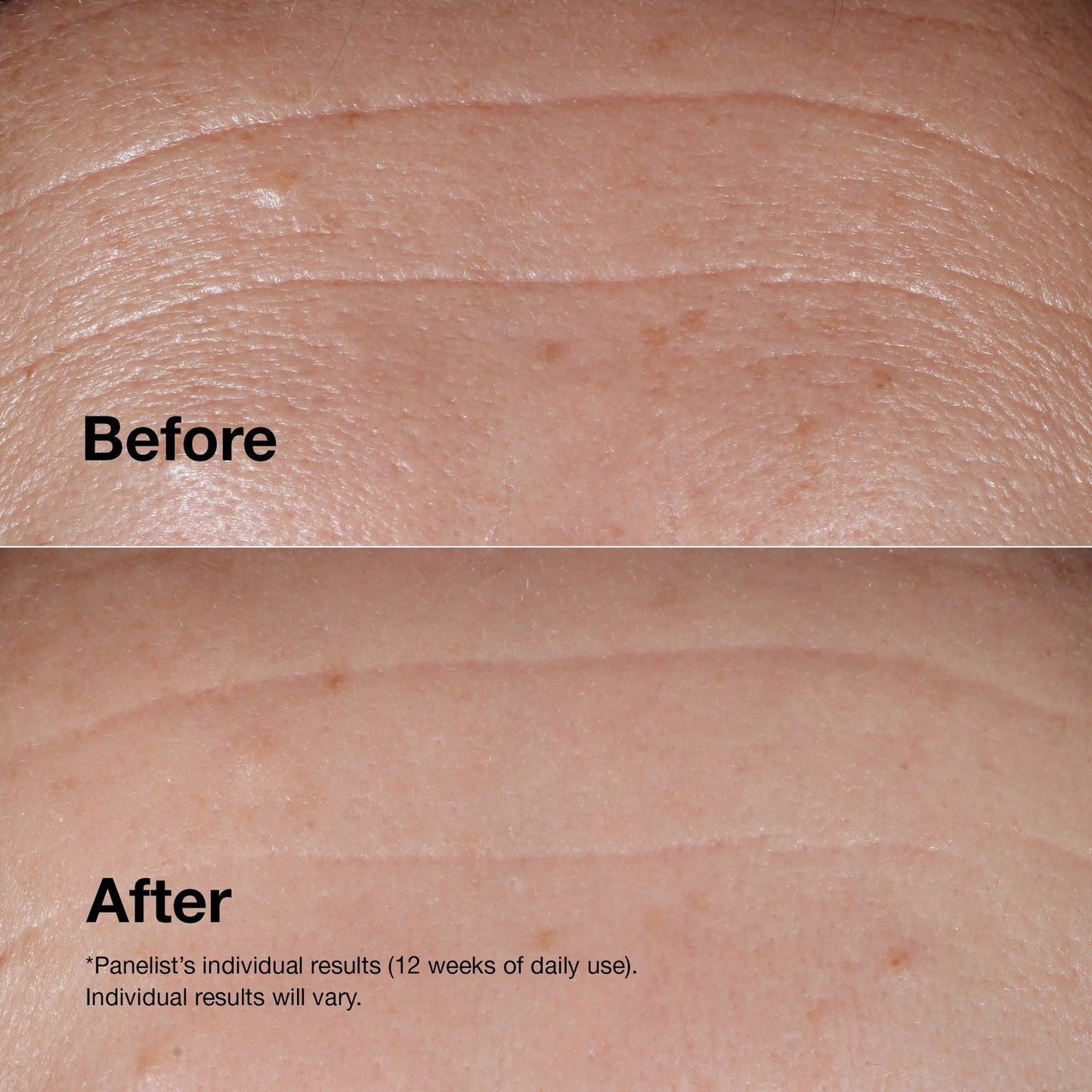 Clinique Clinique Smart Smart Clinical Repair™ Wrinkle Correcting Serum
