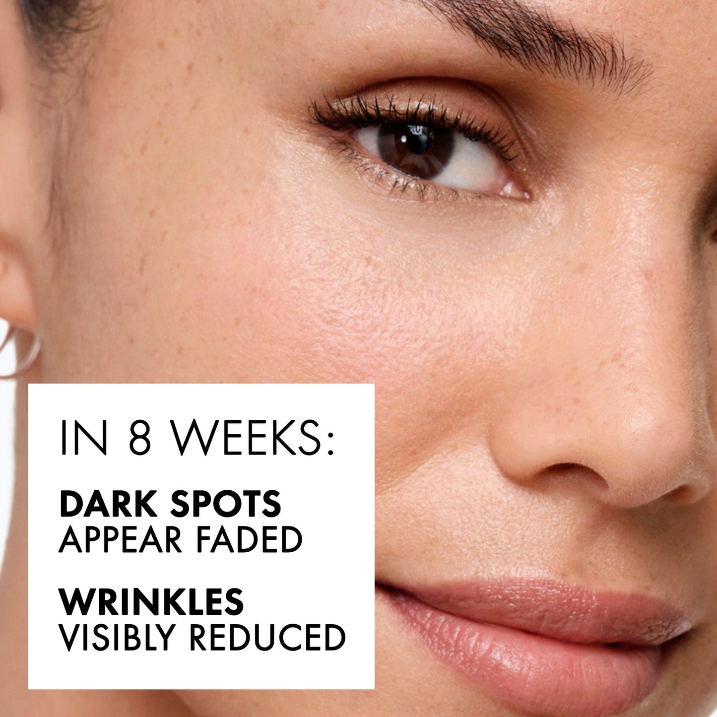 VICHY Liftactiv Specialist B3 5% Niacinamide & AHA Complex Dark Spots & Pigmentation Serum 30ml