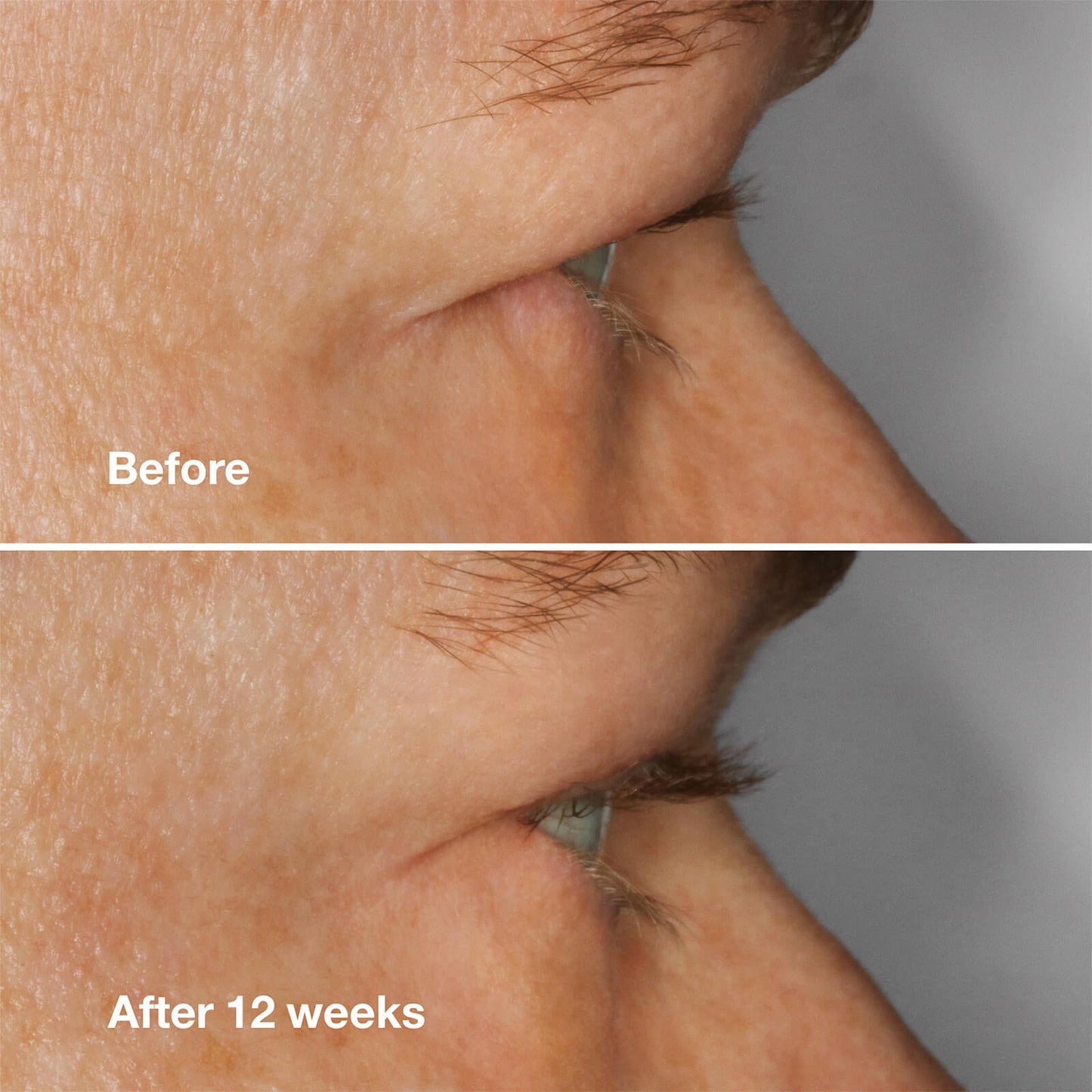 Clinique High Impact™ Lash Amplifying Serum