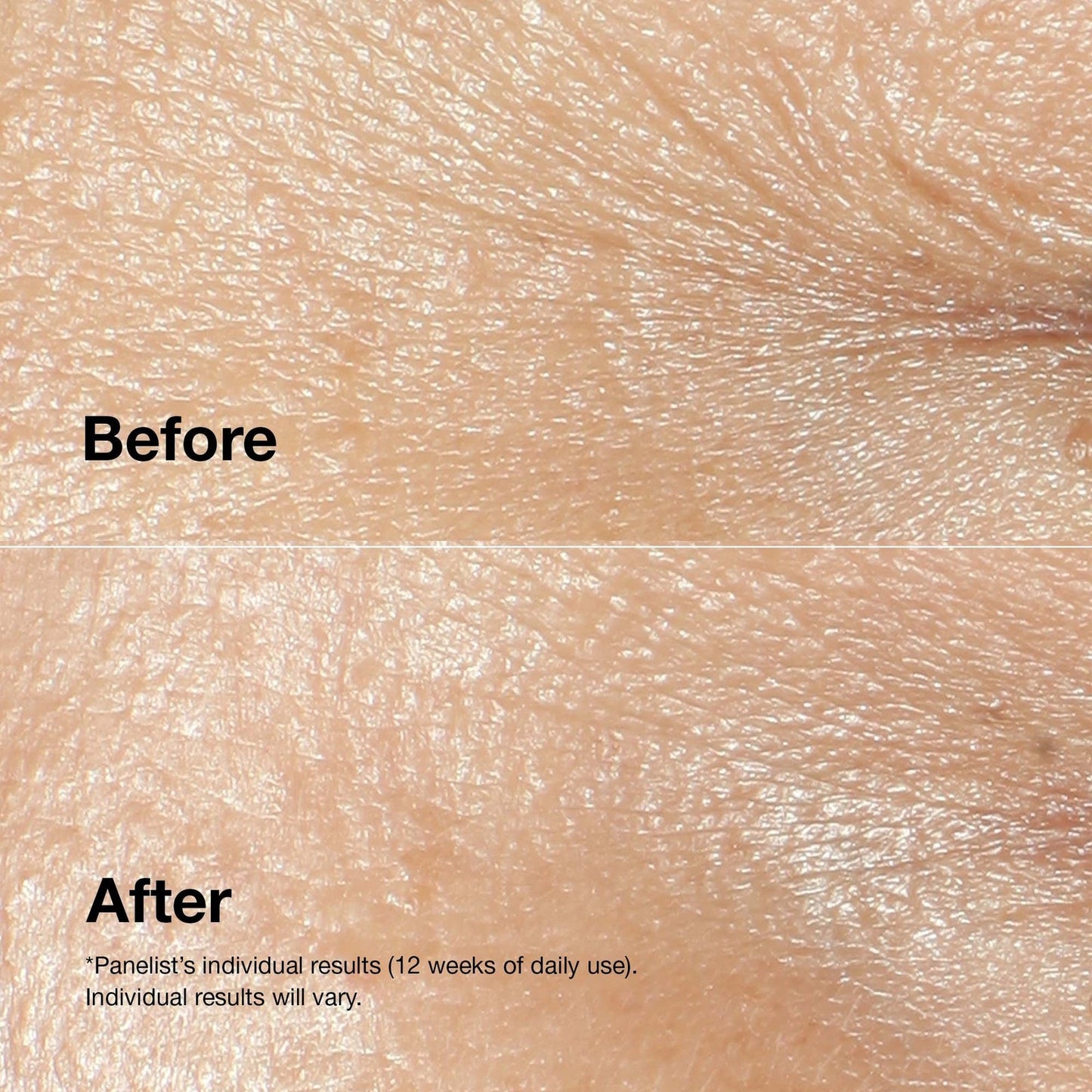Clinique Clinique Smart Clinical Repair™ Wrinkle Correcting Cream