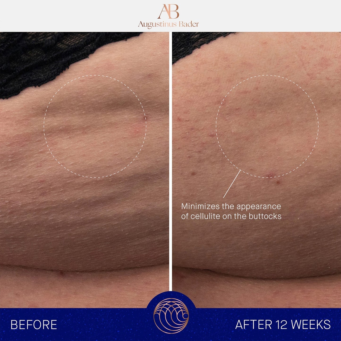 Augustinus Bader The Body Cream Reformulated