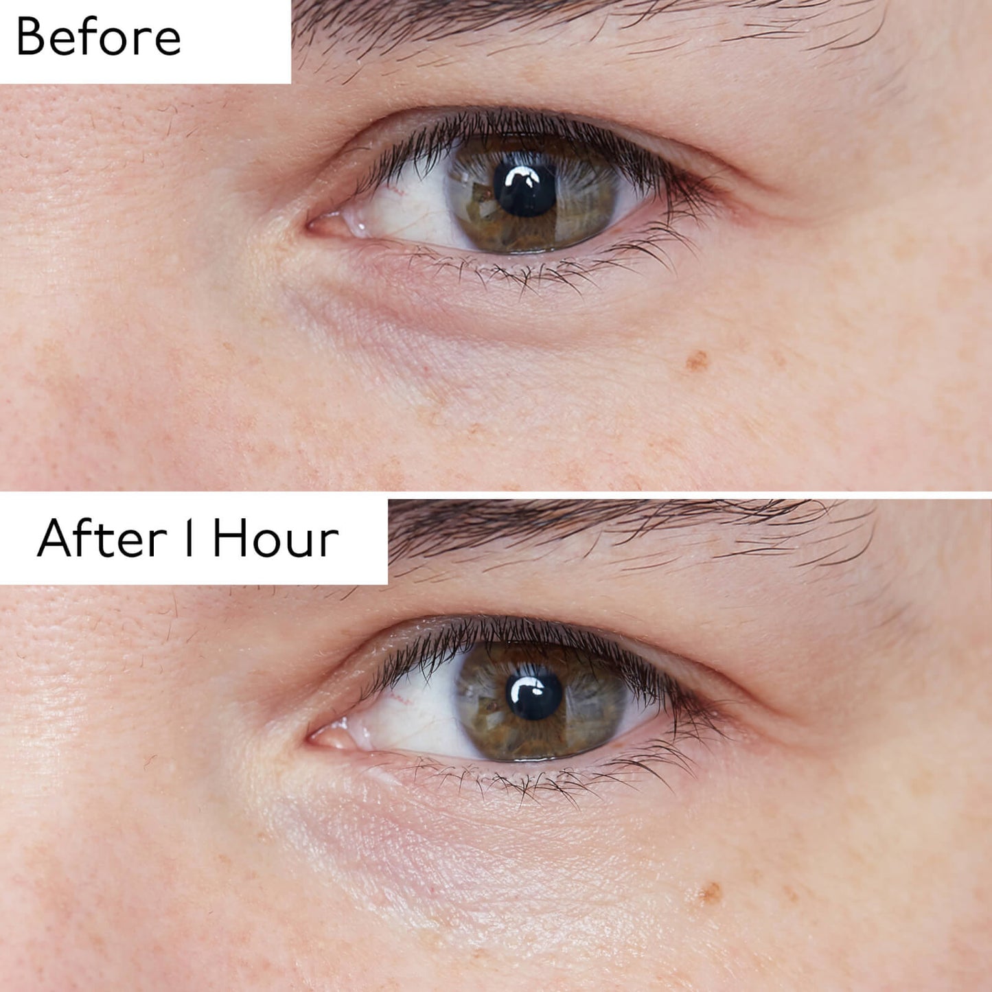 By Terry Hyaluronic Global