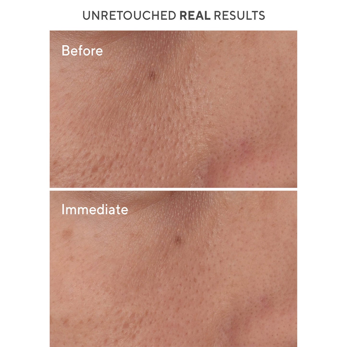 Murad Targeted Pore Corrector 15ml