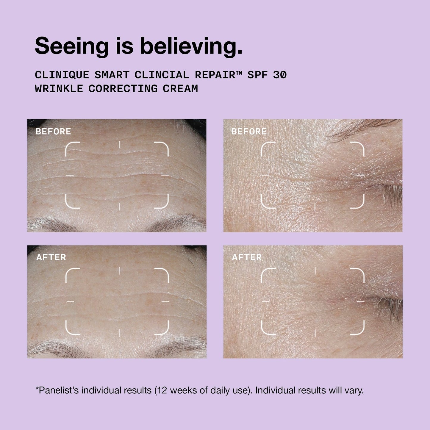 Clinique Clinique Smart Smart Clinical Repair Wrinkle Correcting Cream SPF 30