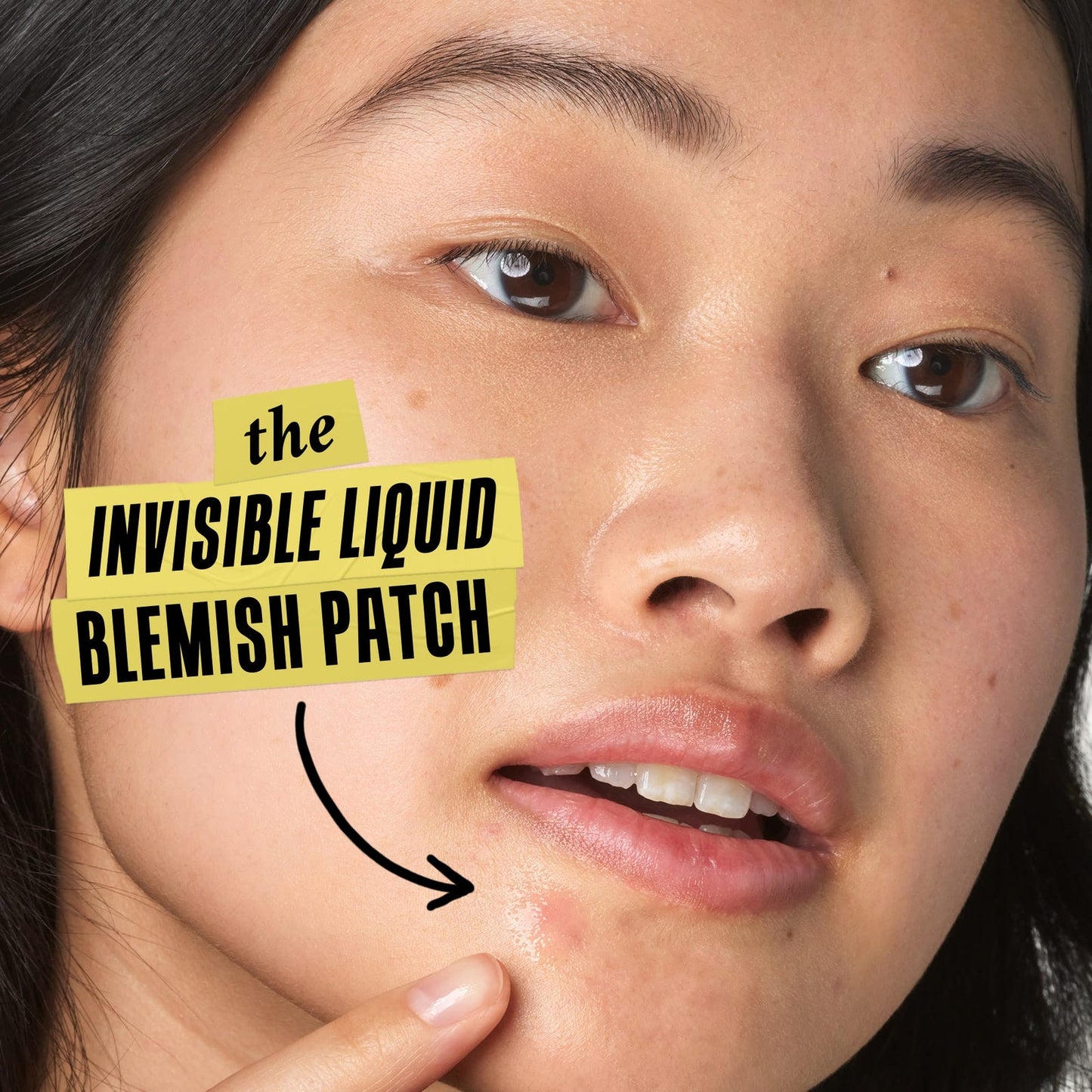 Kiehl’s Truly Targeted Blemish-Clearing Solution