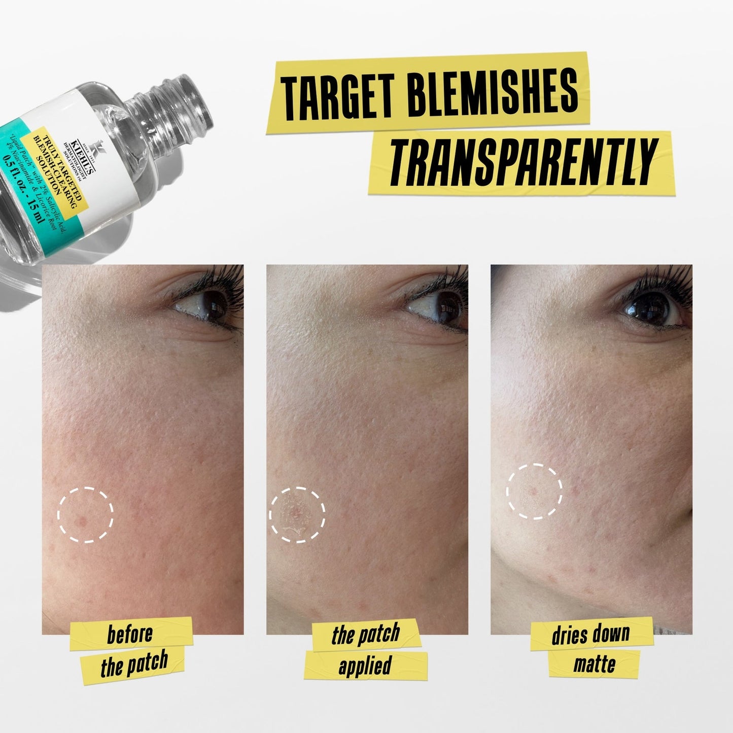 Kiehl’s Truly Targeted Blemish-Clearing Solution