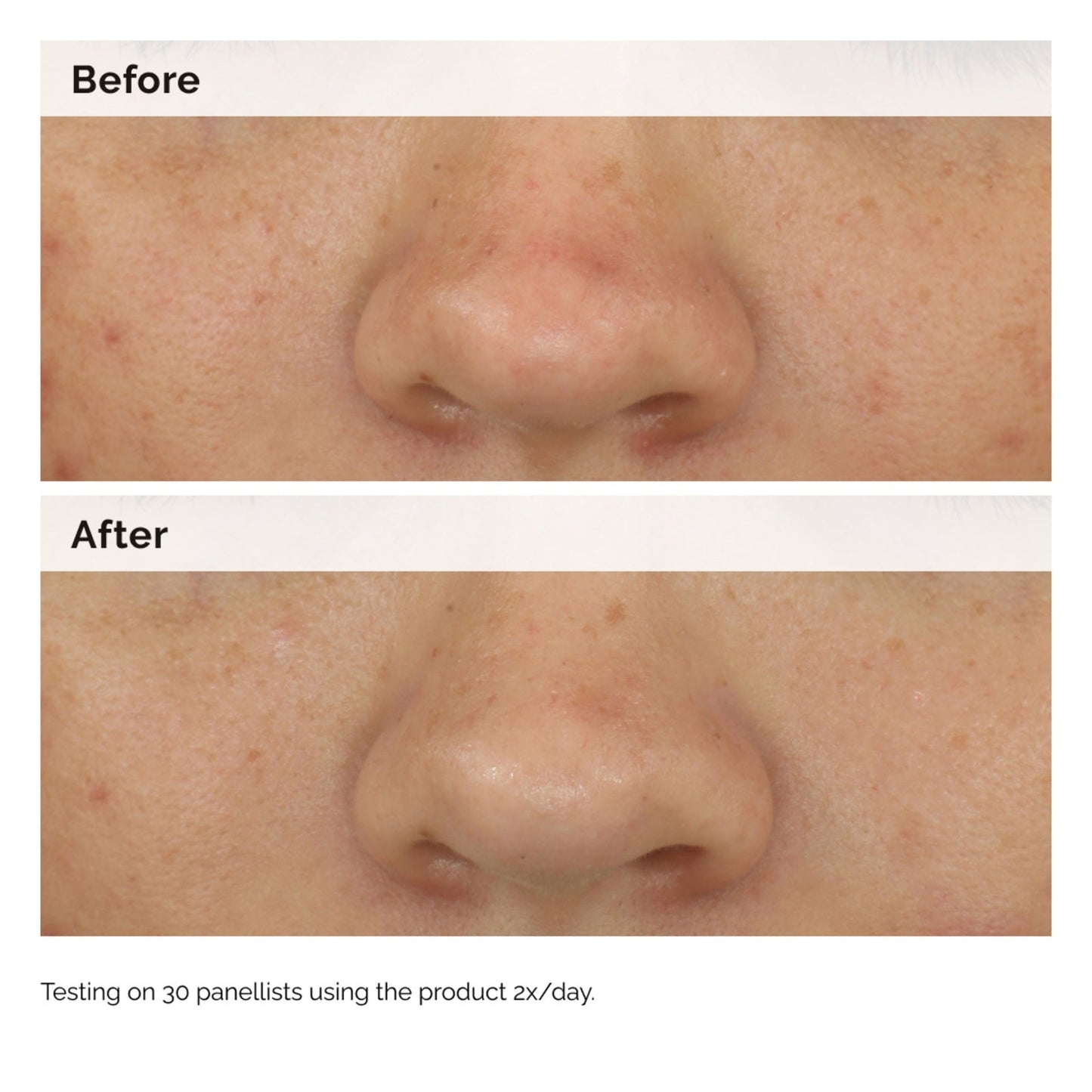 The Ordinary Balancing & Clarifying