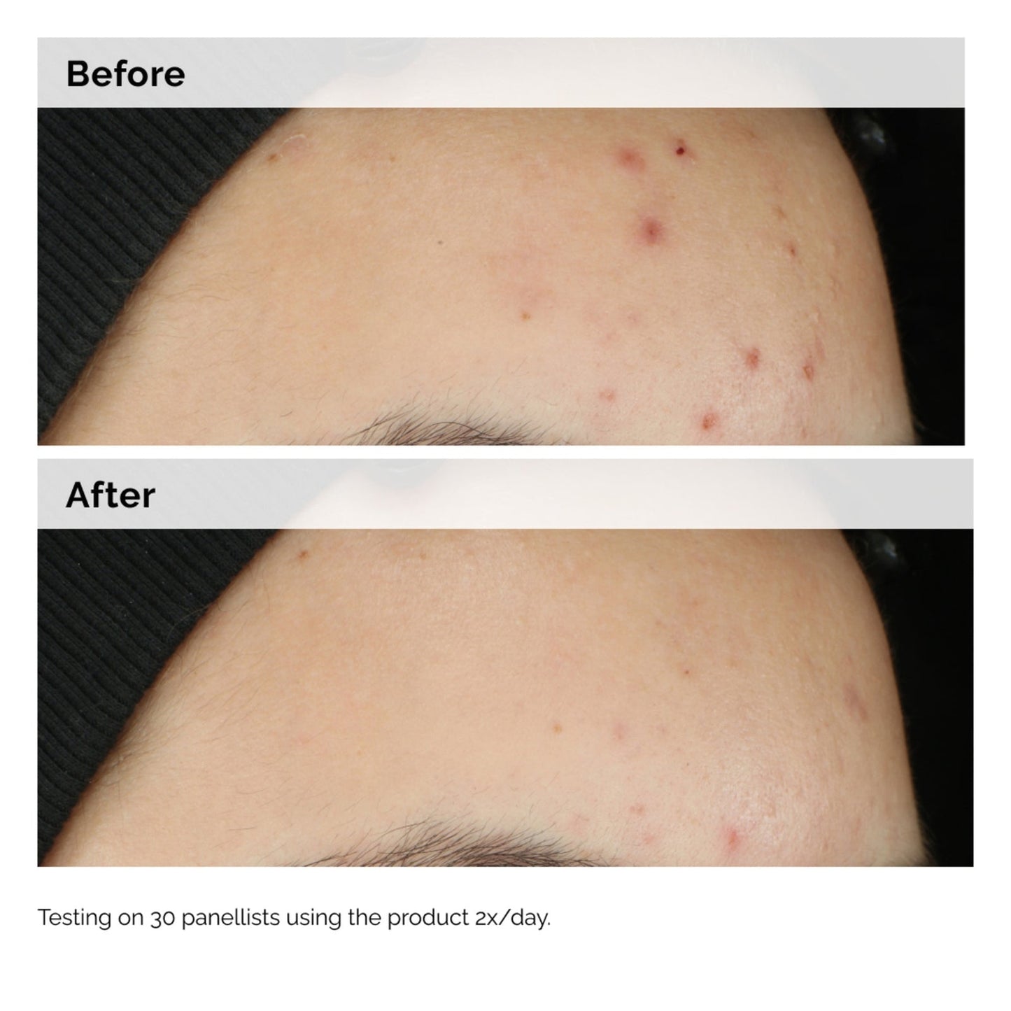The Ordinary Balancing & Clarifying