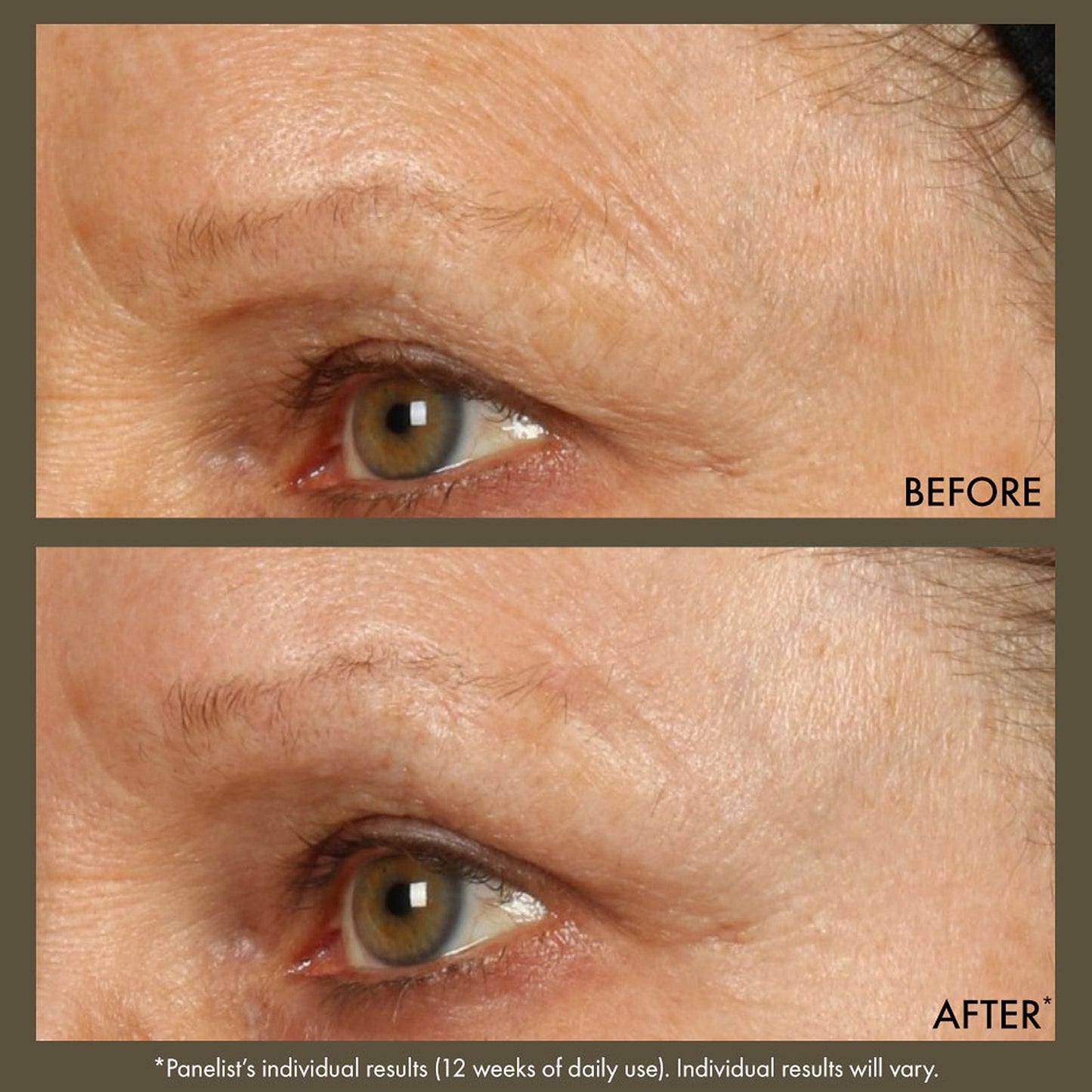 Origins Plantscription™ Active Wrinkle Correction Serum