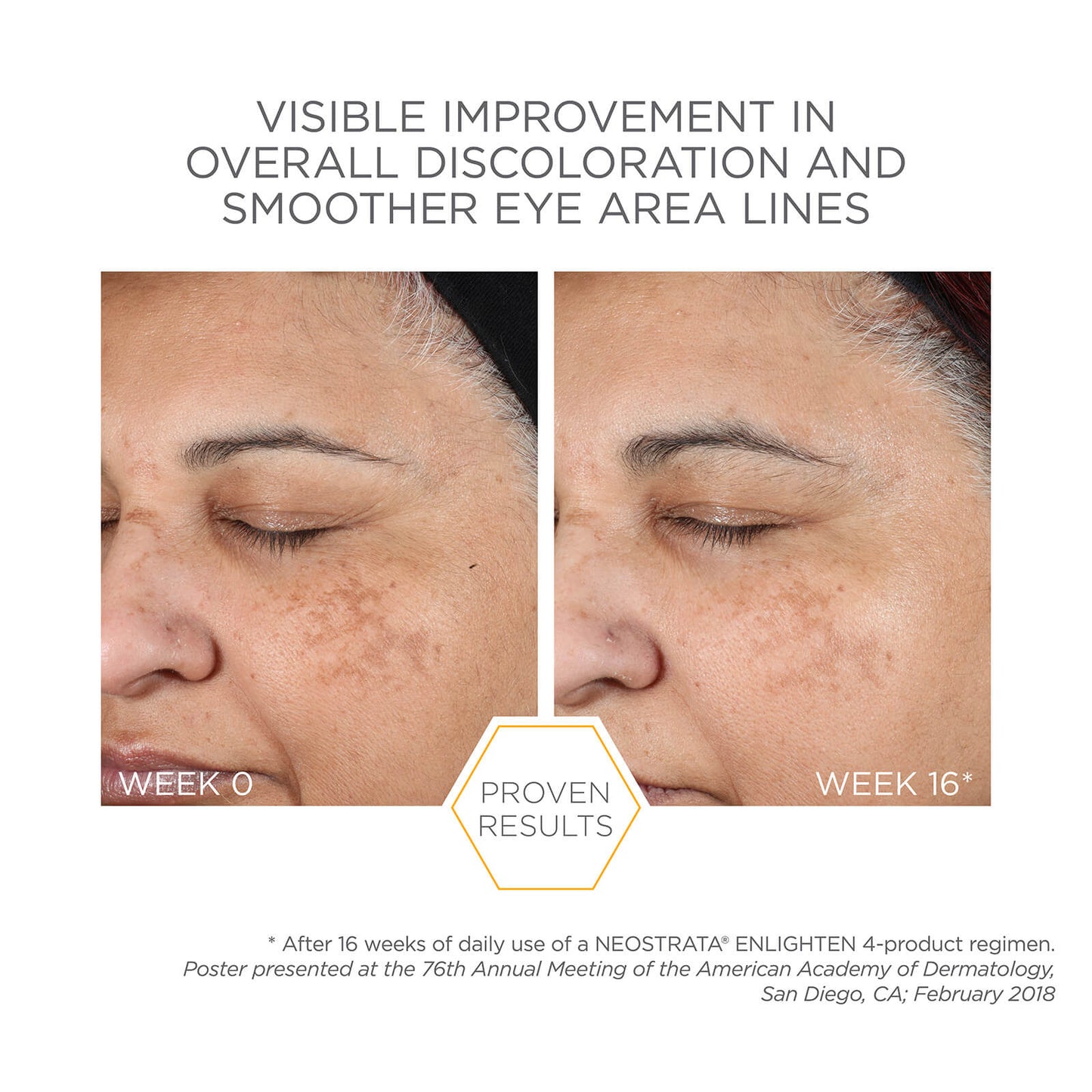 Neostrata Enlighten Pigment Controller Cream with Retinol & Vitamin C 50ml