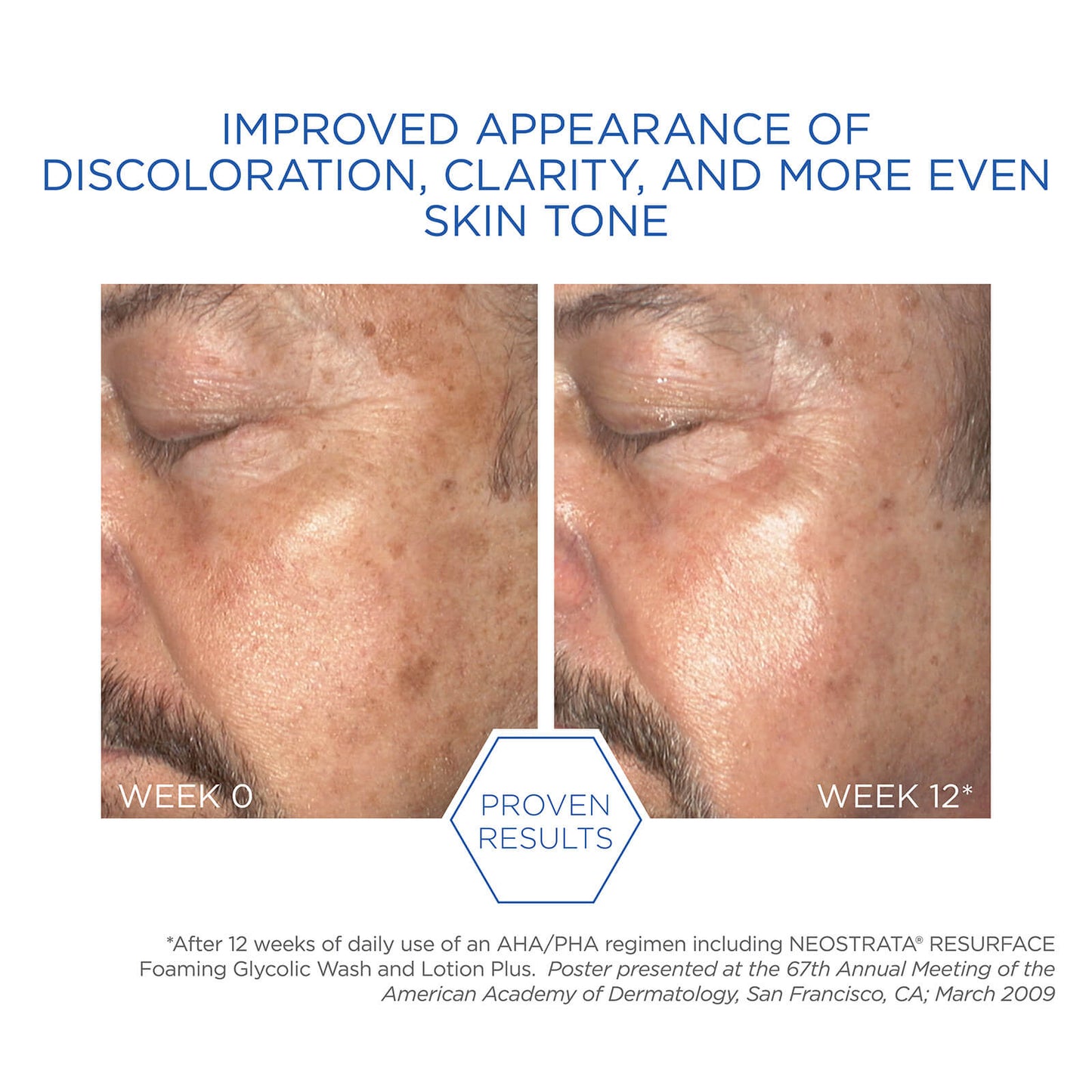 Neostrata Foaming Glycolic Wash AHA 20 - 4.2 fl.oz