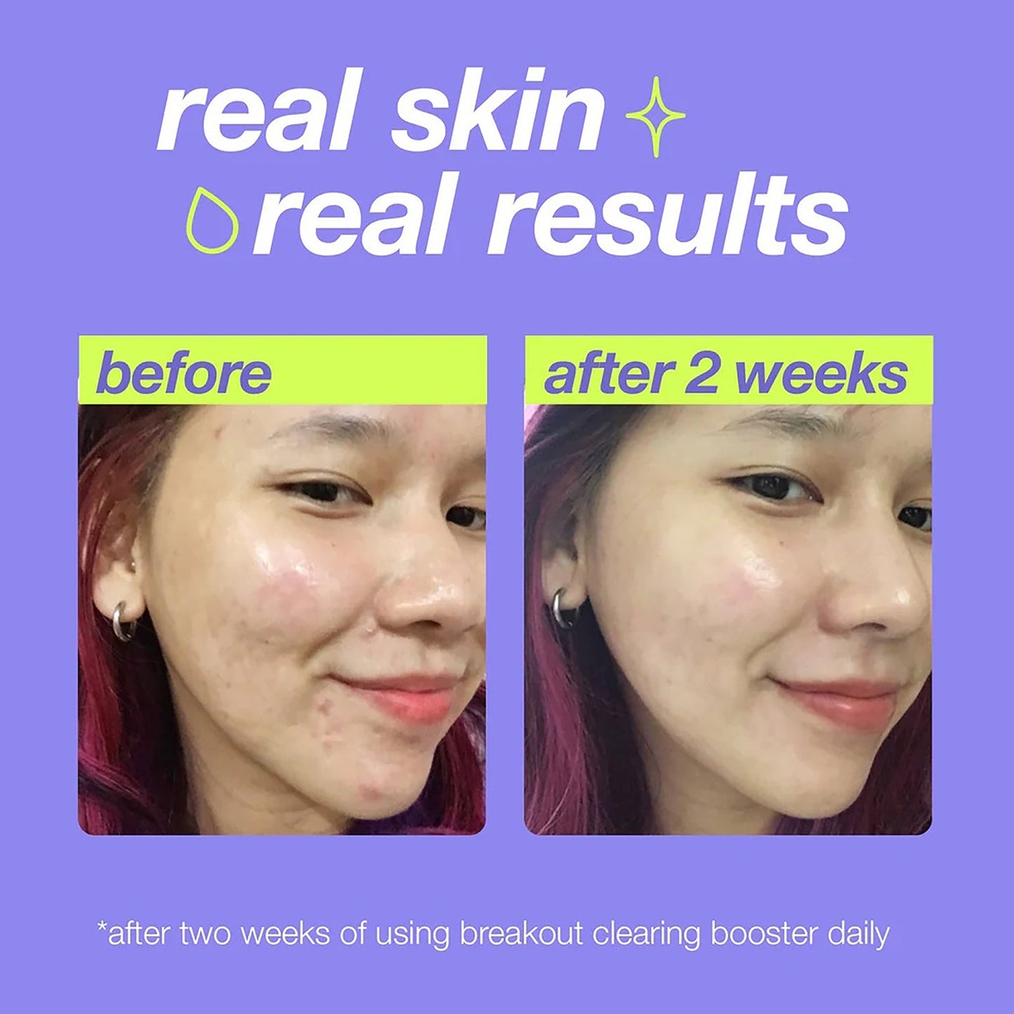 Dermalogica Clear Start Clear Start Breakout Clearing Booster
