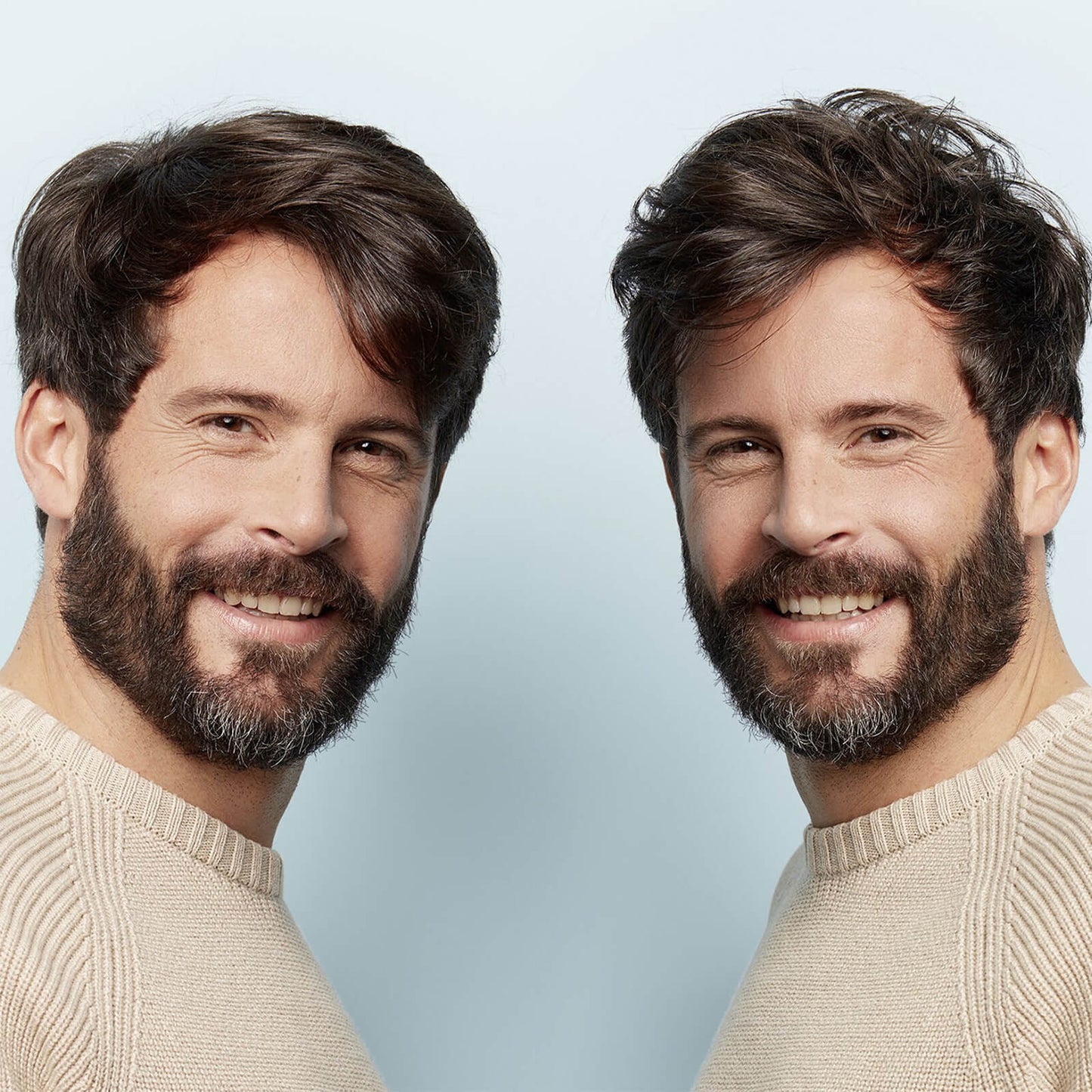 NIOXIN 3-Delig Systeem 2 Hoofdhuid- en Haarbehandeling voor natuurlijk haar met gevorderde uitdunning 100ml