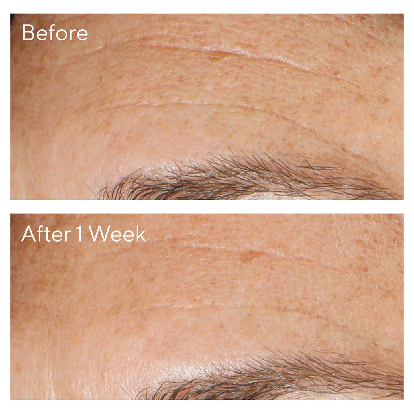 Murad Replenishing Multi-Acid Peel 100ml