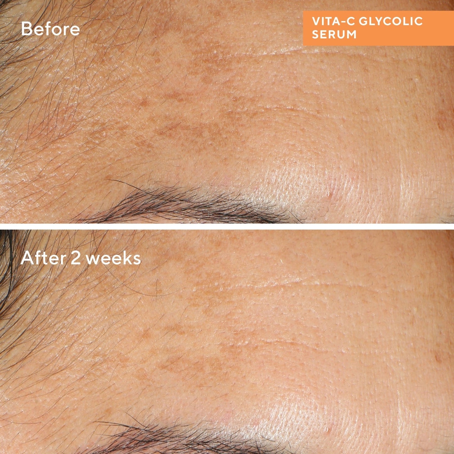 Murad Vita-C Glycolic Brightening Serum 30ml