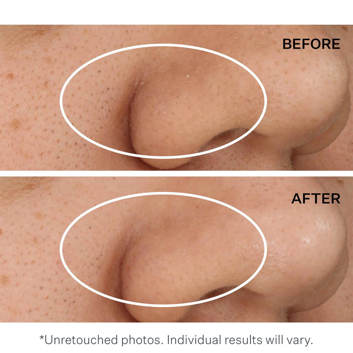 StriVectin Daily Reveal Exfoliating Pads (Pack of 60)