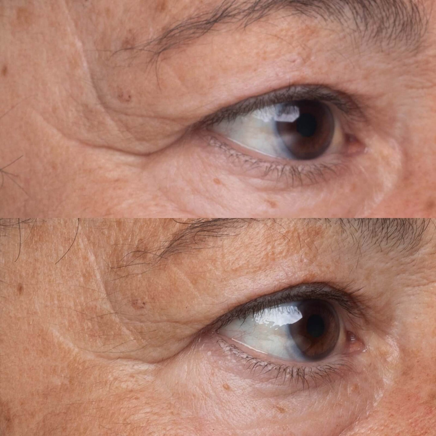 Perricone MD High Potency Growth Factor Firming & Lifting Eye Serum 0.5oz FG