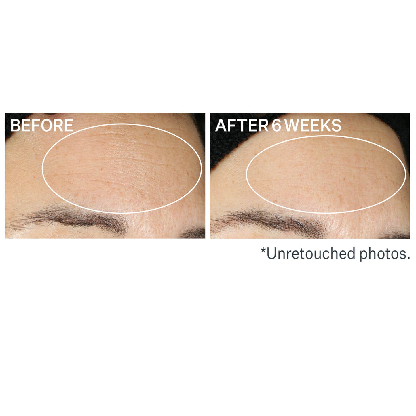 StriVectin Super-B Barrier Strengthening Oil 30ml