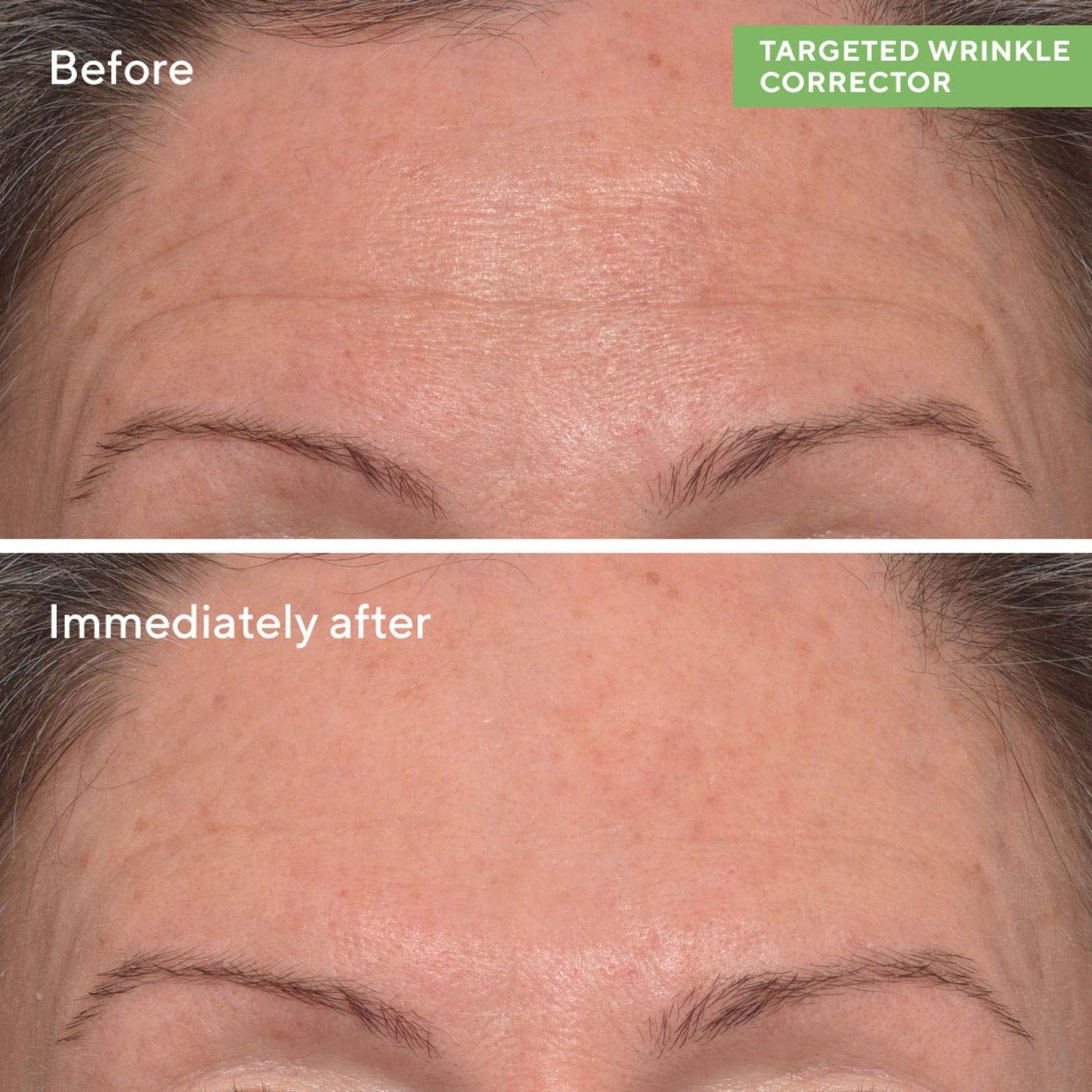 Murad Targeted Wrinkle Corrector 15ml