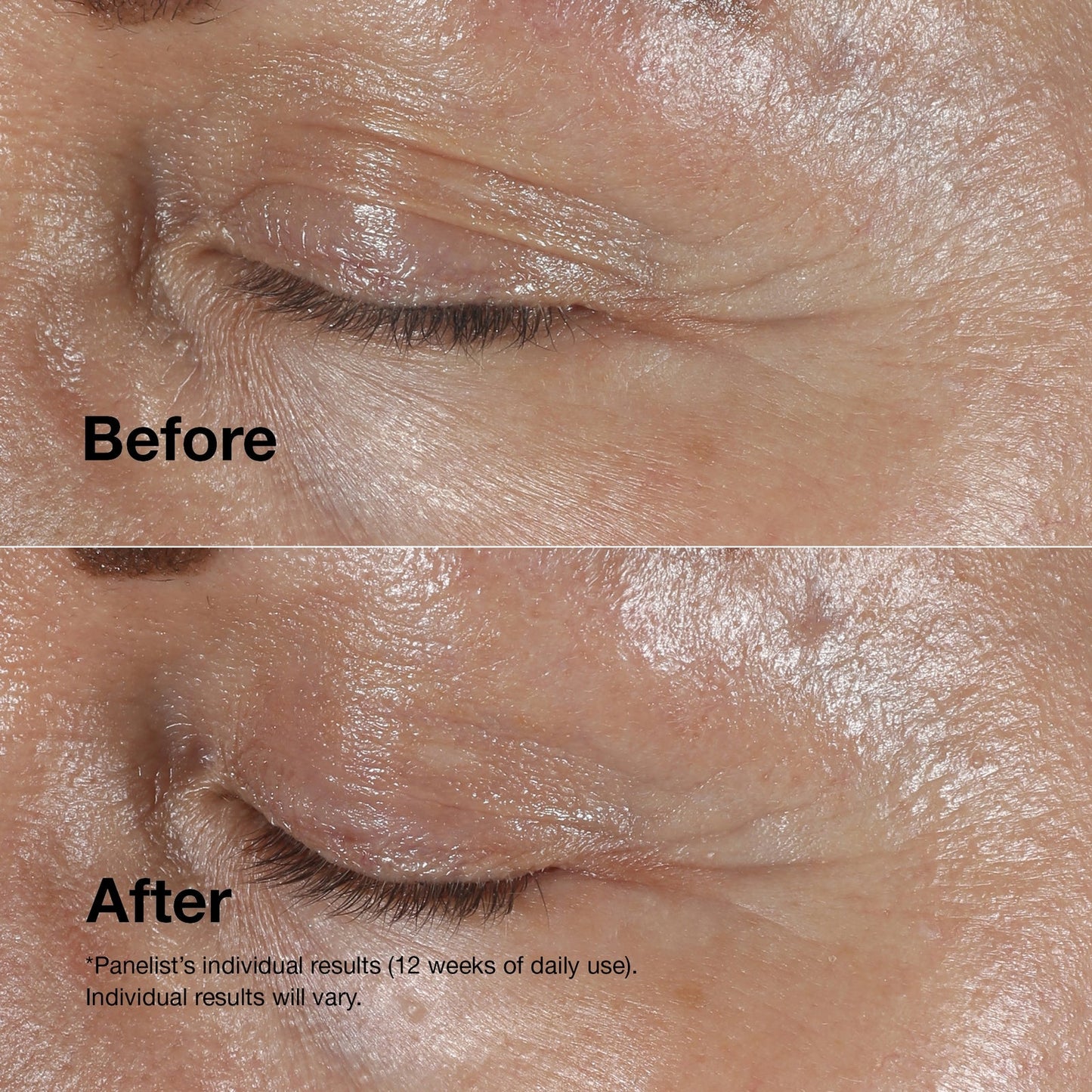 Clinique Clinique Smart Smart Clinical Repair Wrinkle Correcting Eye Cream