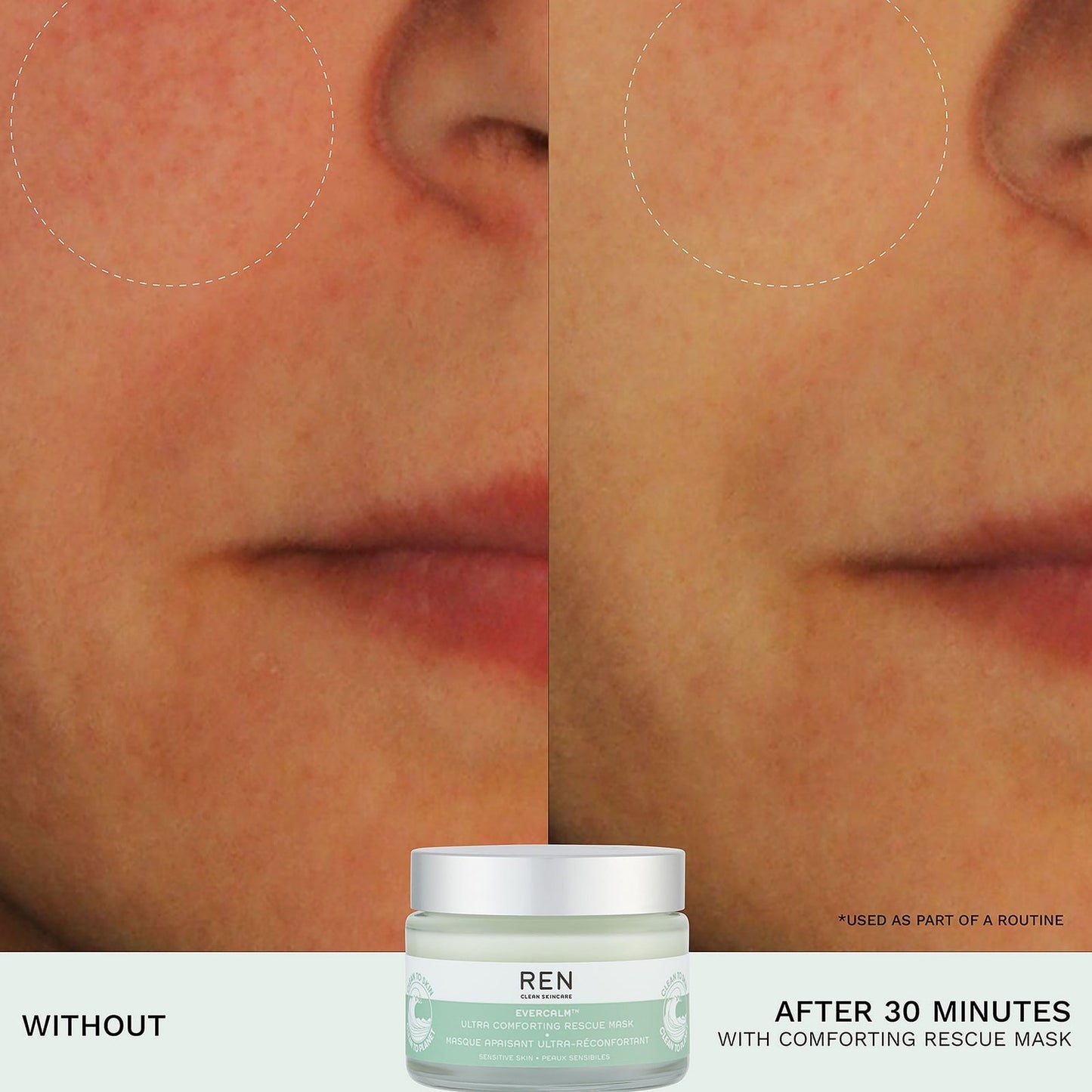 REN Clean Skincare Ultra Comforting Rescue Masker 50 ml