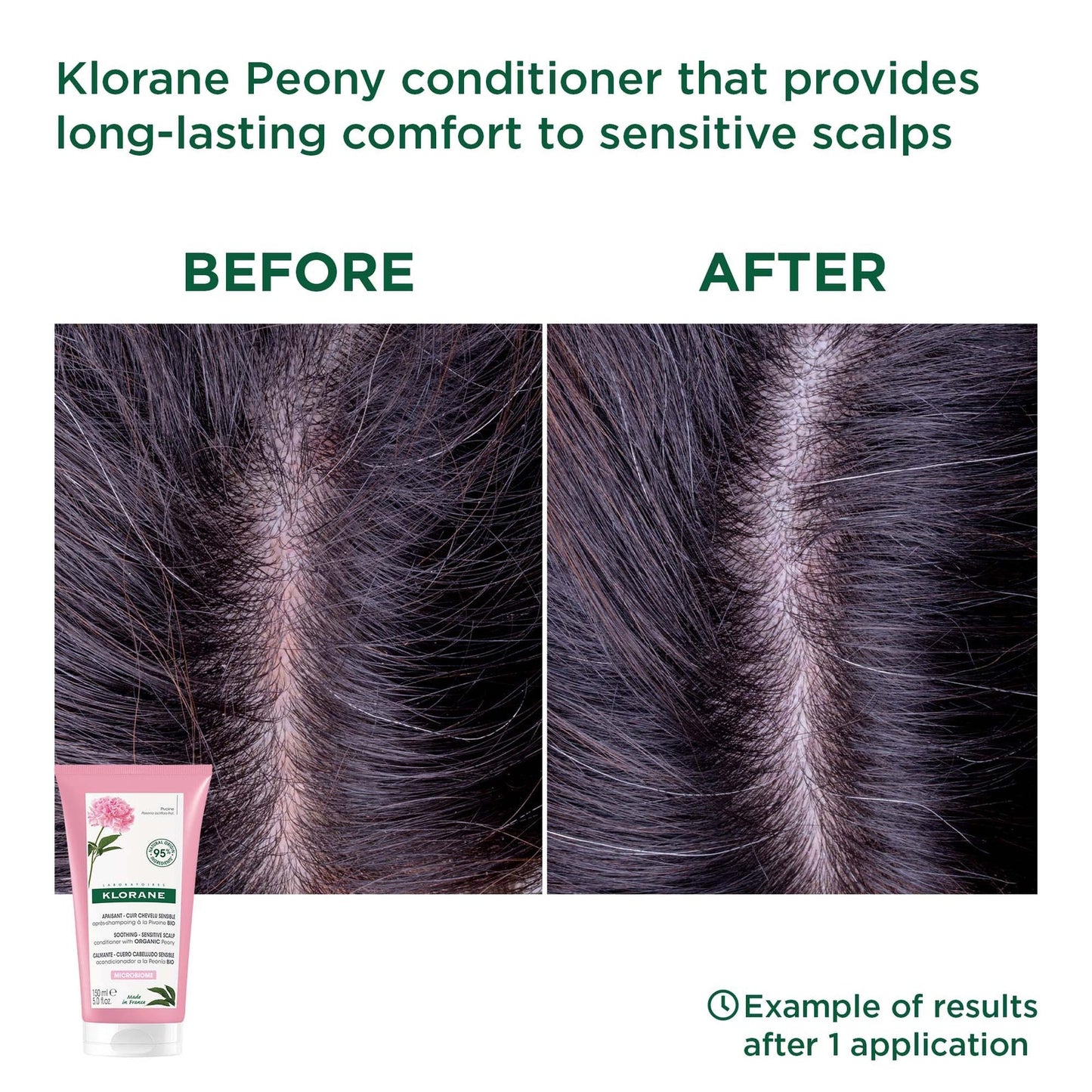KLORANE Soothing Conditioner with Organic Peony for Dry, Sensitive Scalps 150ml