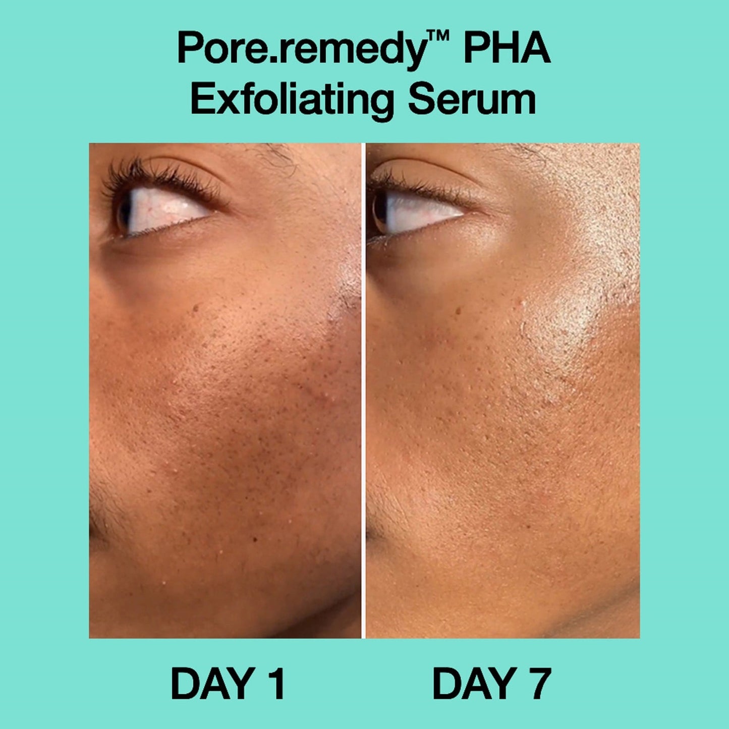 Dr. Jart+ Pore-Remedy™ PHA Exfoliating Serum