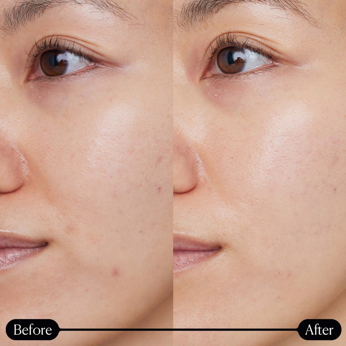 Elemis Dynamic Resurfacing Super-C Serum 30ml