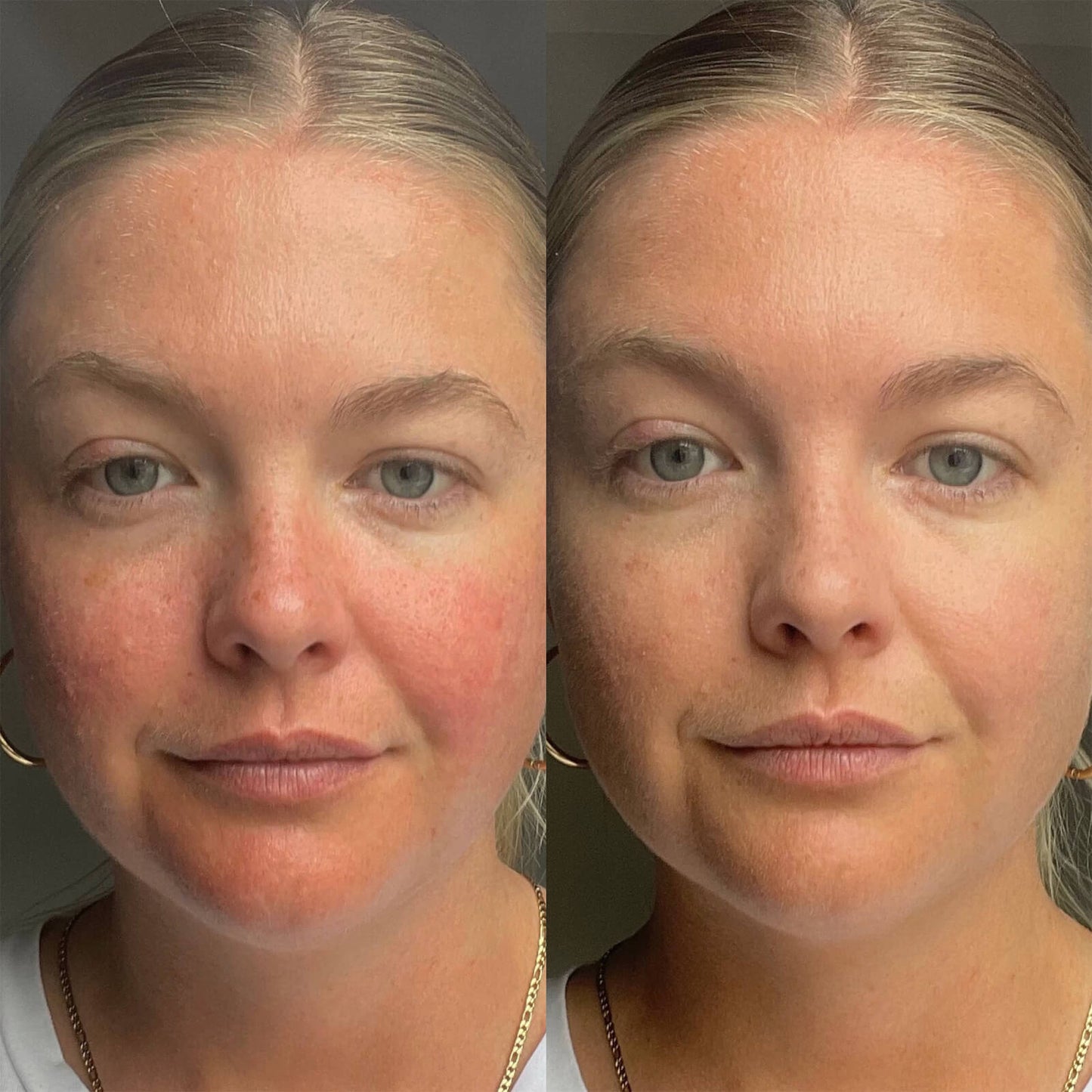 Dr. Jart+ Cicapair™ Tiger Grass Camo Drops