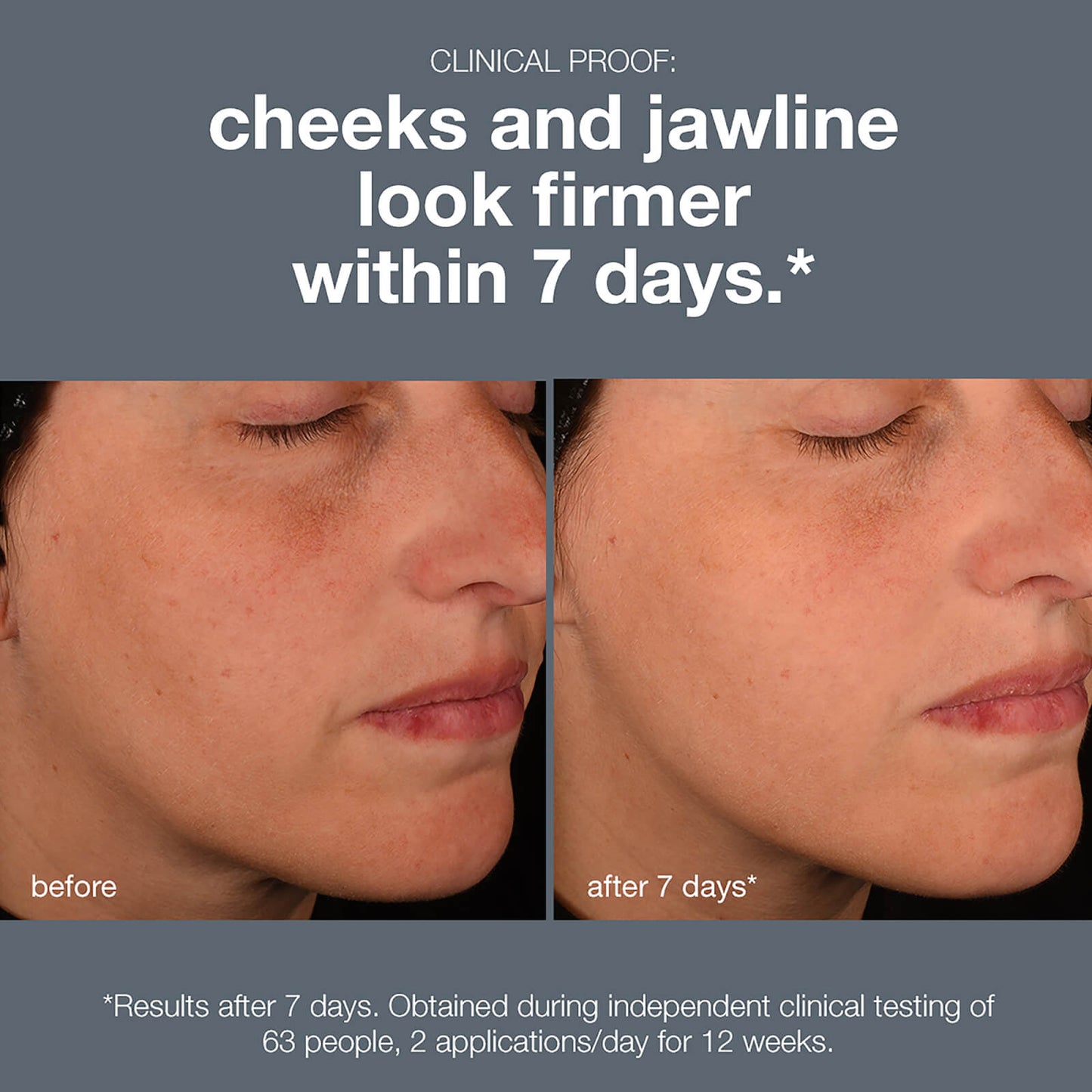 Dermalogica Pro Collagen Banking Serum