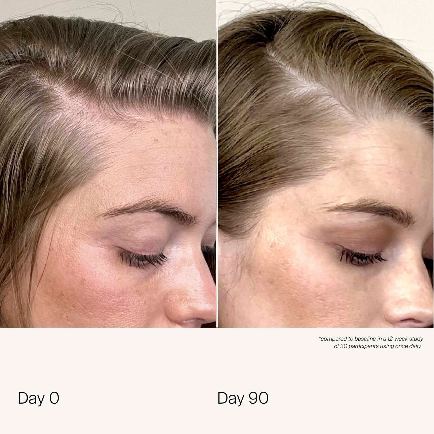 Living Proof scalp care Density Serum