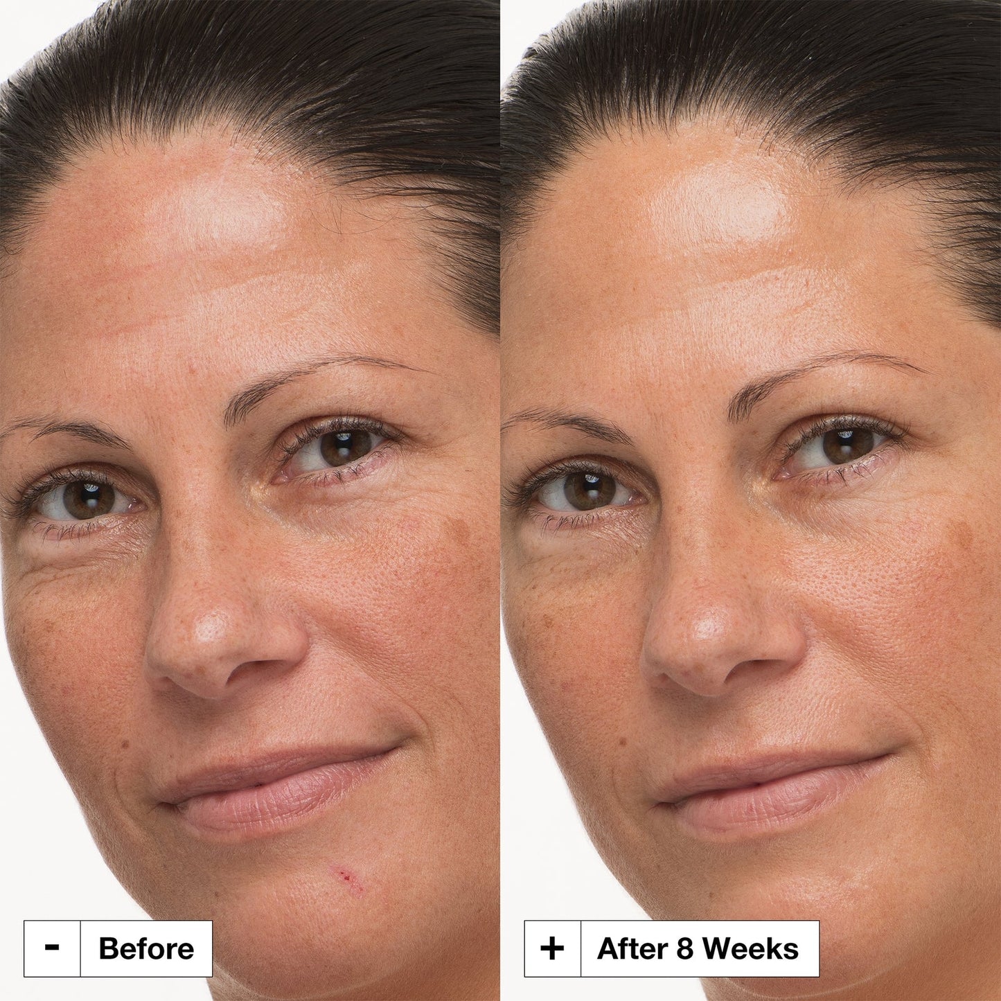 Dr. Jart+ Prejuvenation Prejuvenation Firming Bakuchiol Cream