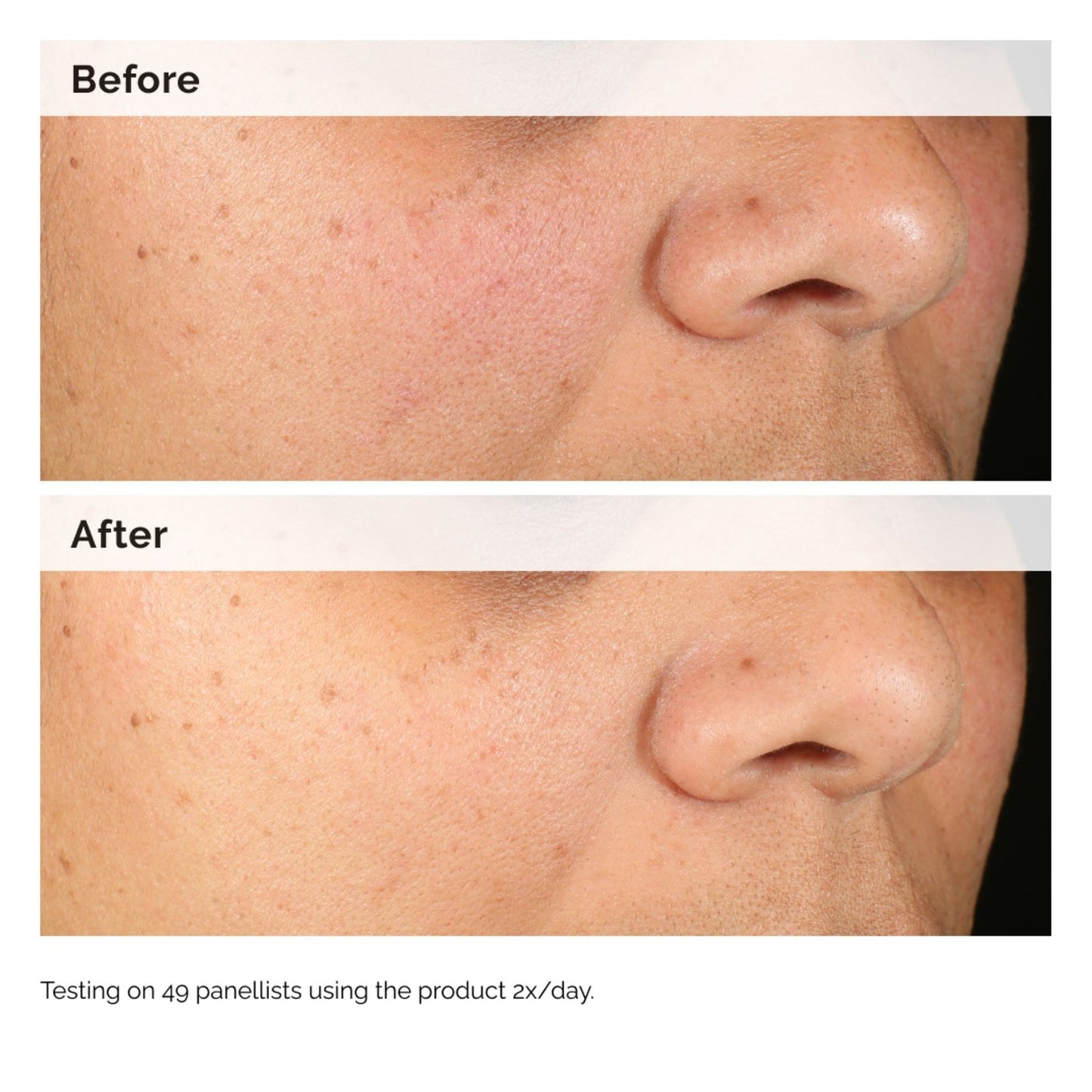 The Ordinary Alpha Arbutine 2% + HA