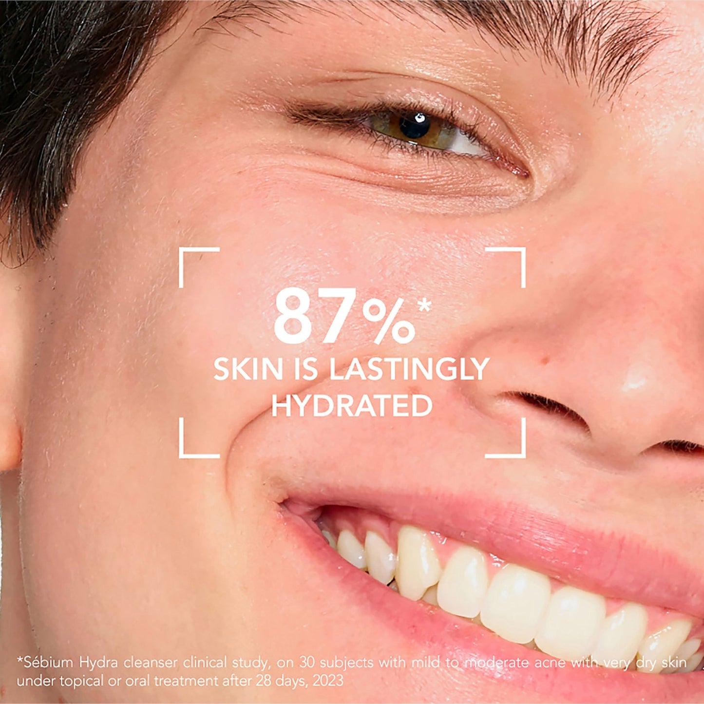 Bioderma Sebium Hydra Cleanser for Dry Acne-Prone Skin 200ml